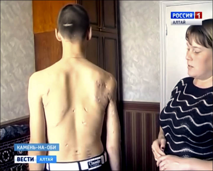 Boy attacked on Sakhalin