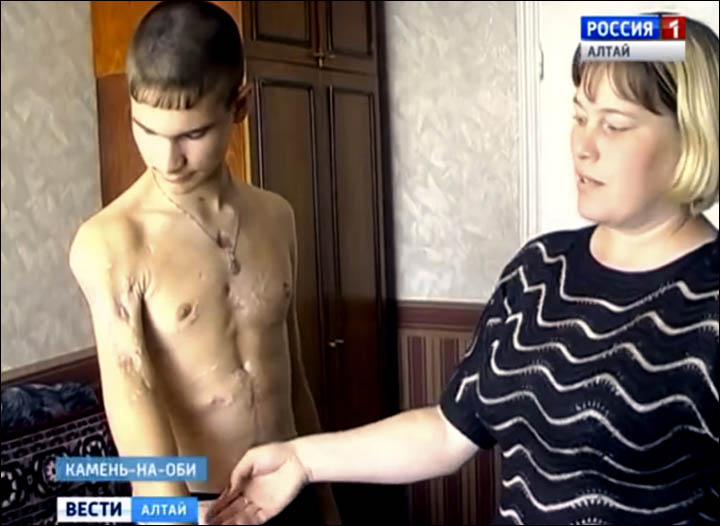Boy attacked on Sakhalin