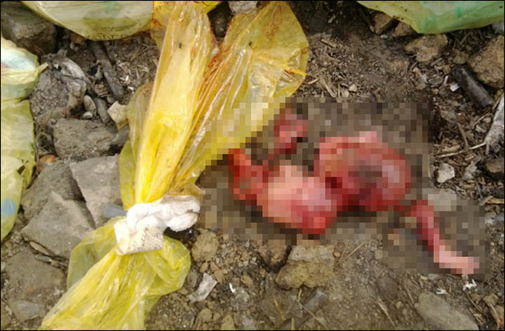 human foetuses among medical waste 'eaten by dogs and birds' at garbage tip  