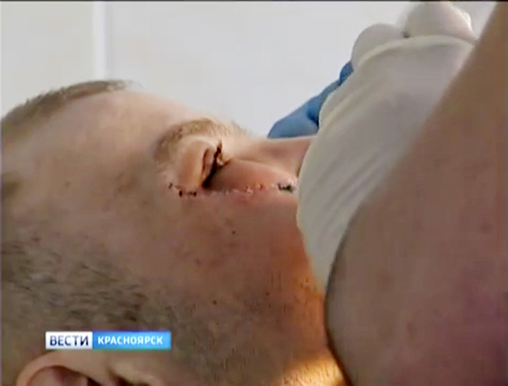 Miraculous escape for man who turns into ‘human Frankenstein’ after freak accident