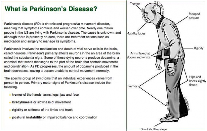 Does alcohol consumption affect the risk for Parkinson's disease?
