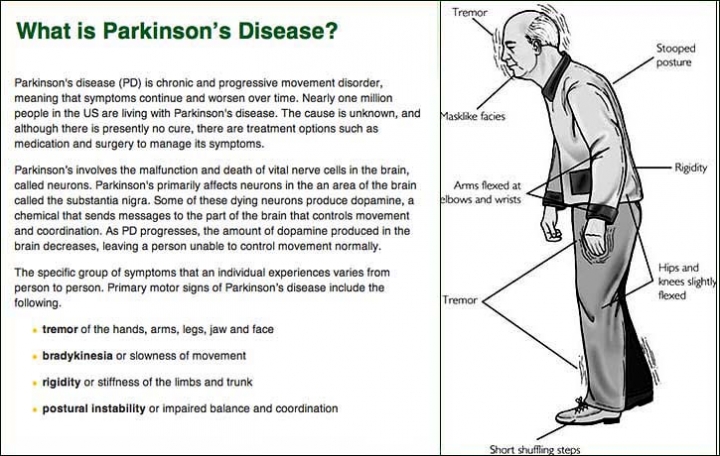 Image result for parkinson's disease