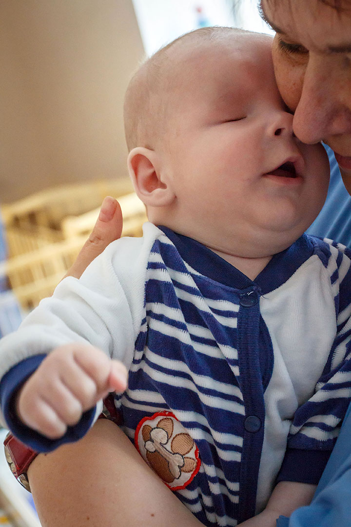 baby born without eyes