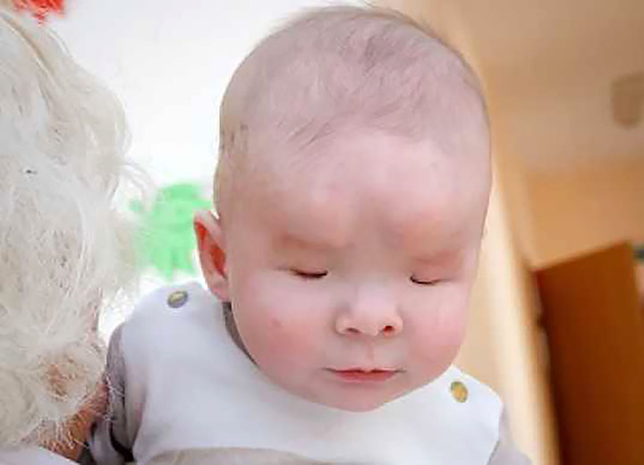 Loving home needed for unique baby born with no eyes 