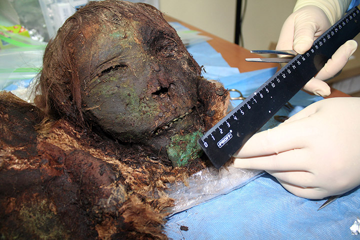 Unusual burial with boy laid to rest with copper cauldron on his head found on the Yamal peninsula 