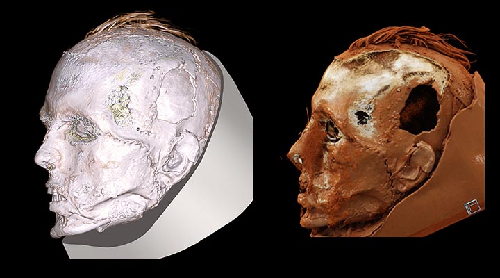 Lifelike face of a tattooed Tashtyk man seen for first time behind a stunning gypsum death mask
