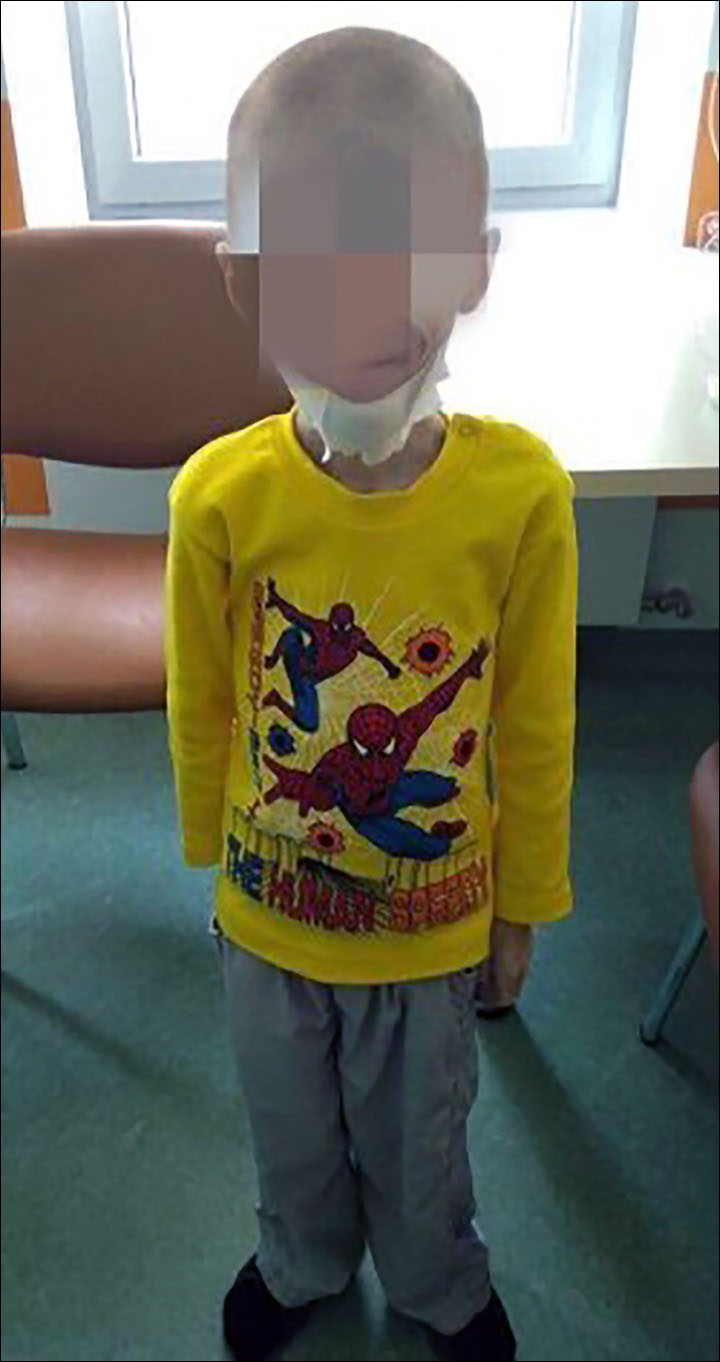 Skin and bones boy aged 11 rescued after weighing in at just 11 kg due to 'food torture'