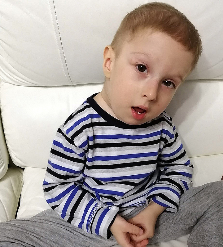 Please help two-year-old Siberian toddler who is turning into a real-life stone statue