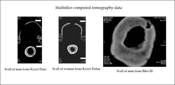 Results of multislice tomography