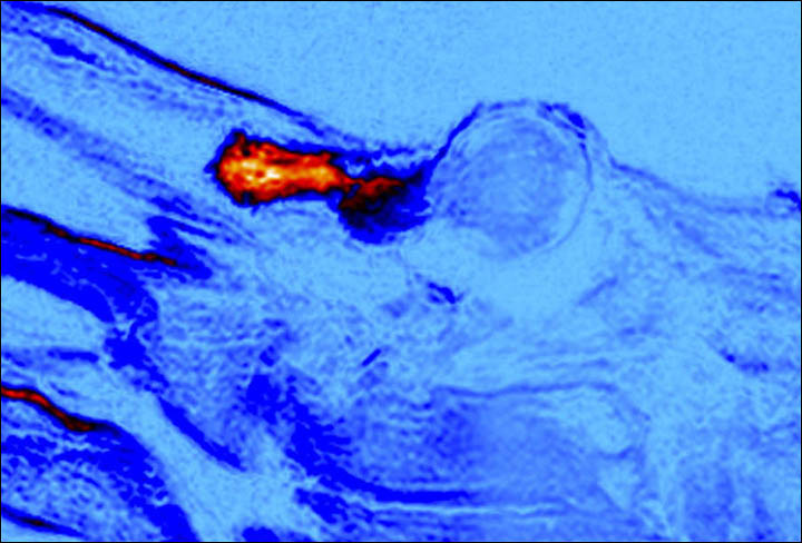 Ukok mummy MRI scan